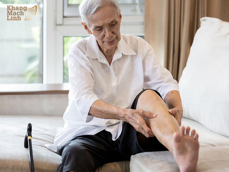 Triệu chứng suy giãn tĩnh mạch