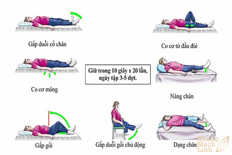 Vật lý trị liệu suy giãn tĩnh mạch chân
