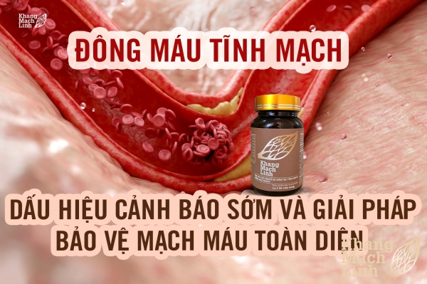 Đông máu tĩnh mạch: Dấu hiệu cảnh báo sớm và giải pháp bảo vệ mạch máu toàn diện