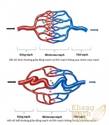Động mạch, tĩnh mạch, mao mạch khác nhau như thế nào?